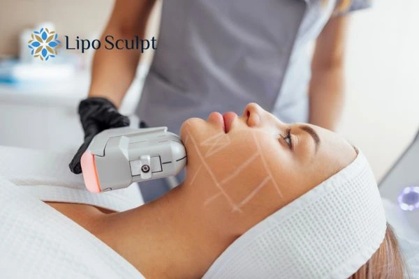 HIFU vs Botulinum Toxin: Understanding the Differences 1 HIFU vs Botox Derbyshire What is the best option for you?