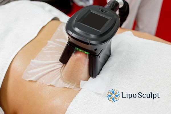 Does Fat Freezing at Home Work? DIY Devices vs Professional Cryolipolysis 1 How is professional cryolipolysis different Derbyshire?