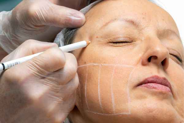 CryoPen: 5 Skin Concerns It May Be Used to Treat 4 What should you ask before having CryoPen treatment Derbyshire?